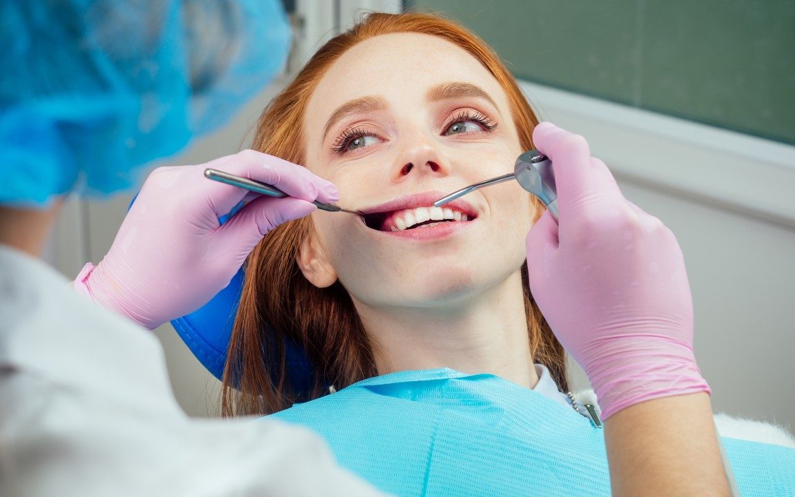 pulizia denti torino